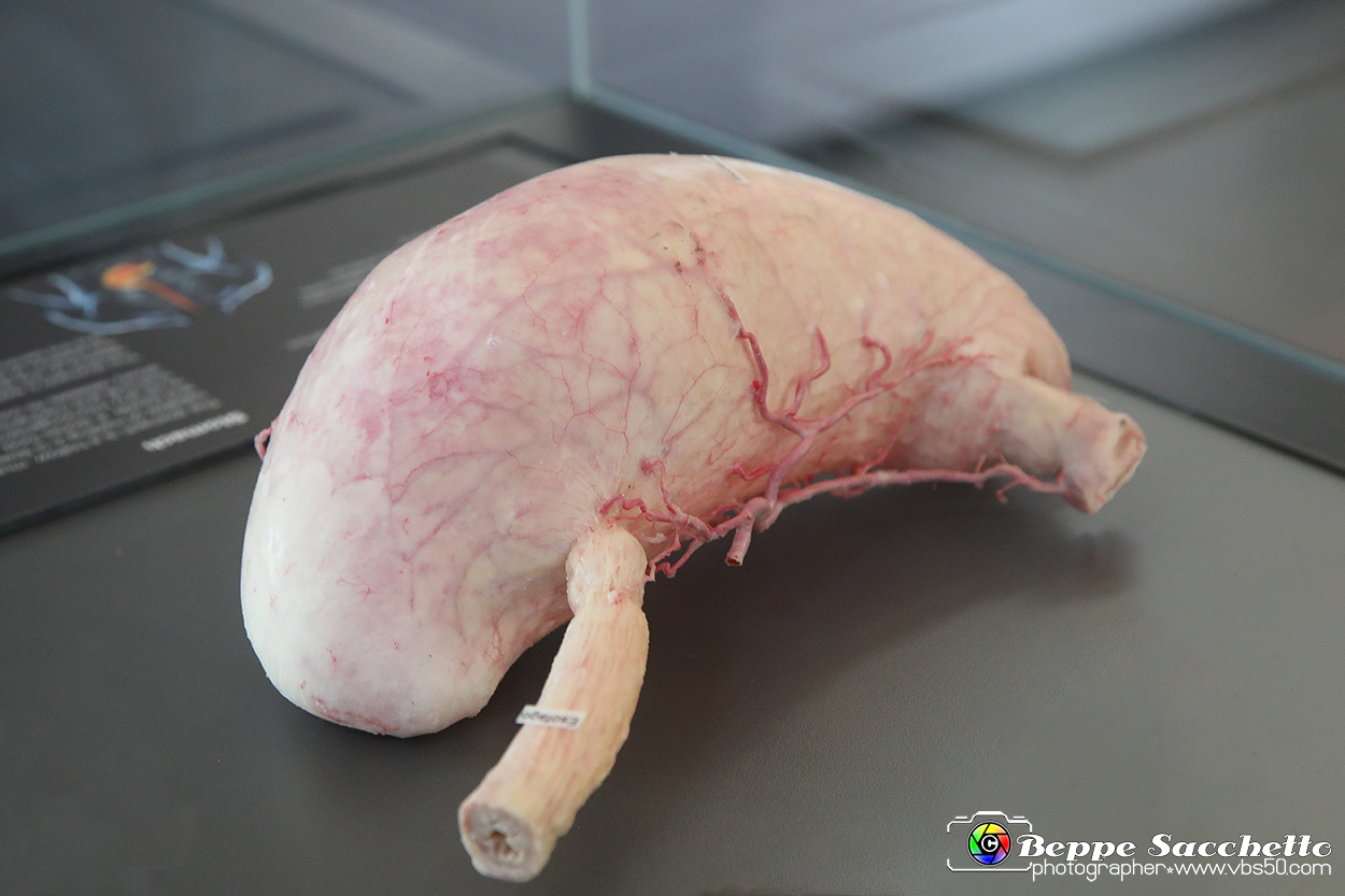 VBS_2776 - Stomaco - Mostra Body Worlds.jpg